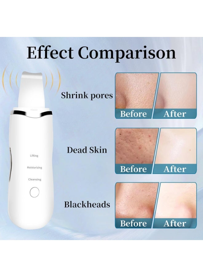 Ultrasonic Skin Scrubber Blackhead Remover – Facial Spatula Tool with Multiple Modes for Deep Cleansing and Daily Skincare - Image 3